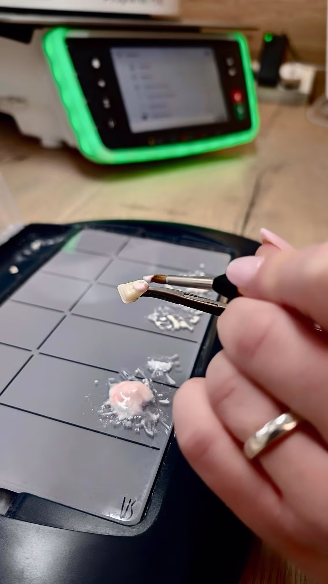 Medizinisches Zahnarztinstrument von Tukoff & Unholzer GbR das Zahnwerk